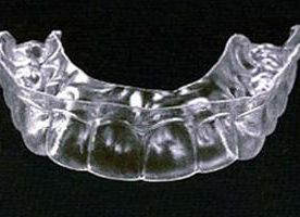 Clínica Dental Pilar Díez García maxilar