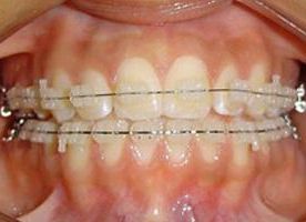 Clínica Dental Pilar Díez García ortodoncia
